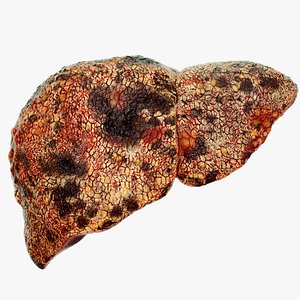 Liver cancer liver disease digestive system organs