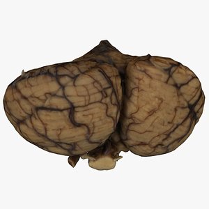 Cerebellum and Brainstem 01