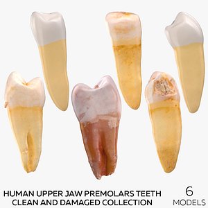 3D model Human Upper Jaw Premolars Teeth Clean and Damaged Collection - 6 models