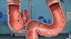 Intestine Medical Model