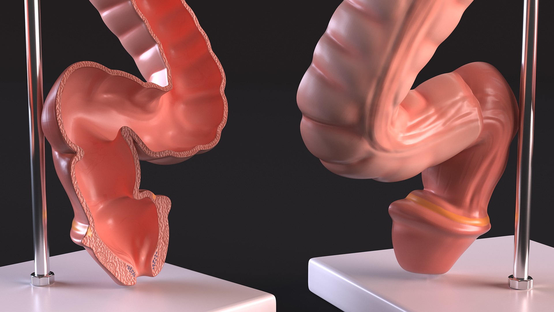 Intestine Medical Model 3D https://p.turbosquid.com/ts-thumb/pI/SHzZ3m/xb/intestinemedicalmodelc4dmodel007/jpg/1683781355/1920x1080/fit_q87/e01f2ecd7fda4e0533233b1e0bbe596cb42fc176/intestinemedicalmodelc4dmodel007.jpg