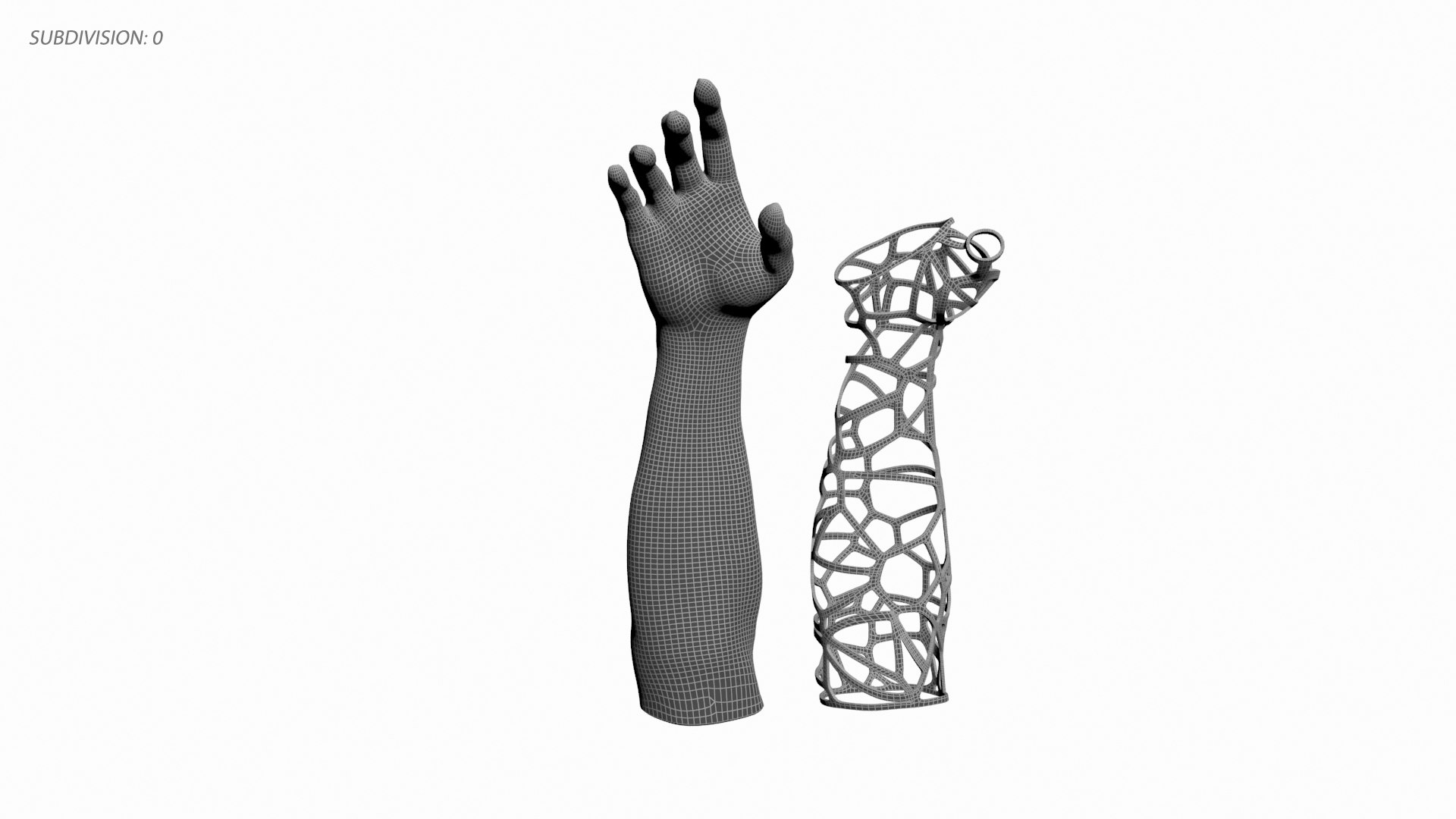 3D-Printed Orthopedic Arm 3D model https://p.turbosquid.com/ts-thumb/pK/vw06mn/FH/4/jpg/1673311137/1920x1080/fit_q87/3aa55523a294c713c560130a2011fff1493f7bf9/4.jpg