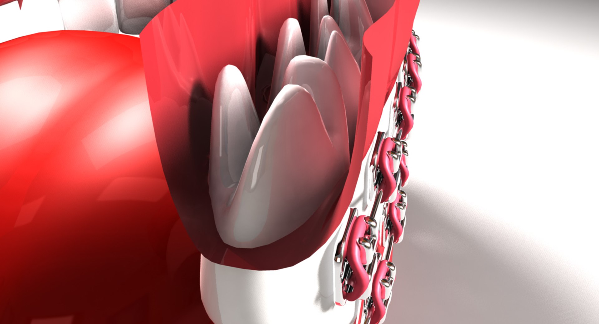 teeth braces 3d model https://p.turbosquid.com/ts-thumb/pS/6oISr2/1lIM30aO/mouth_07.46/jpg/1541002918/1920x1080/fit_q87/b4e0fcf04066bcb701cff56655a4208303a36917/mouth_07.46.jpg