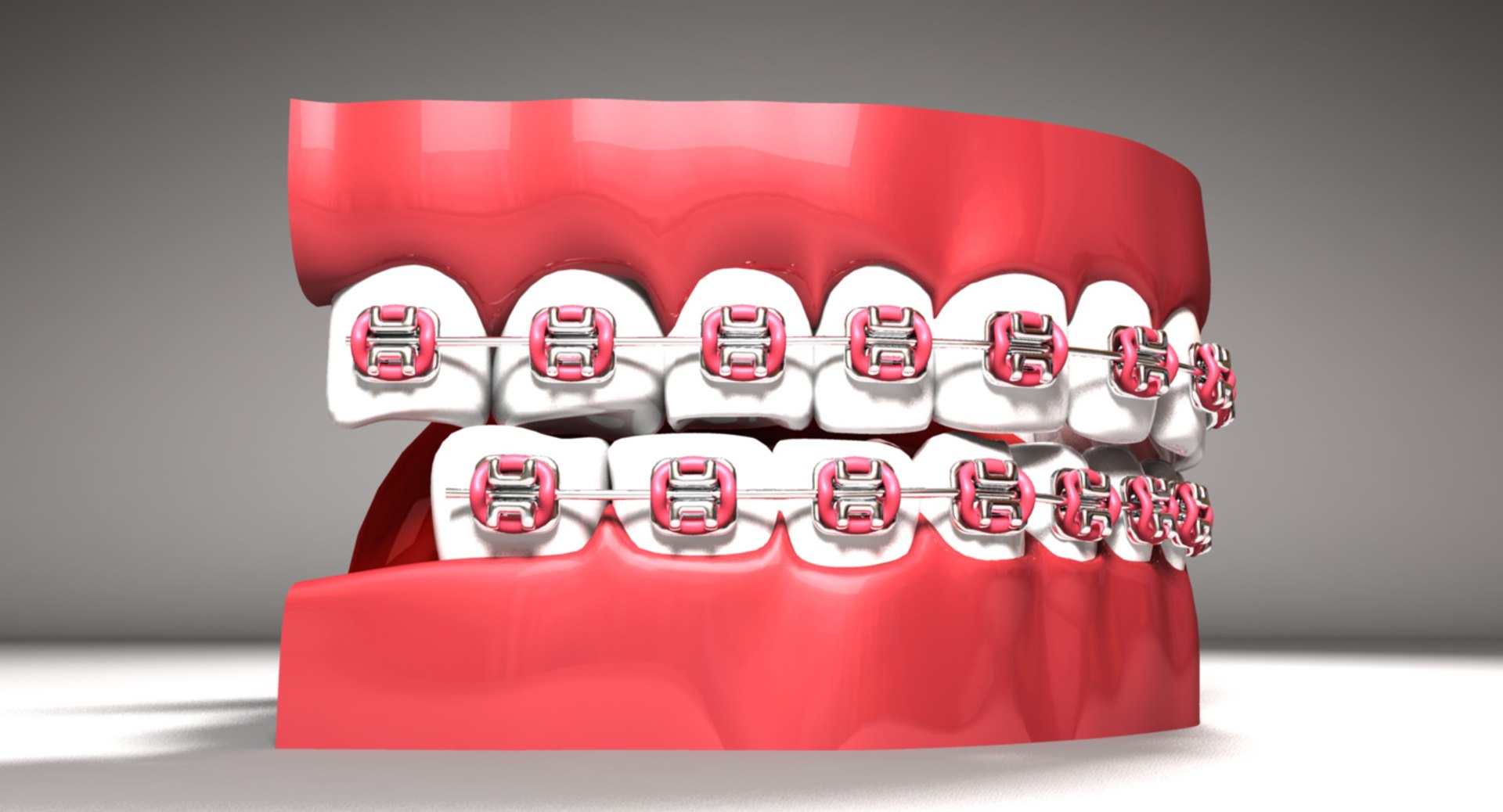 teeth braces 3d model https://p.turbosquid.com/ts-thumb/pS/6oISr2/WxhQpcpK/mouth_07.45/jpg/1541002918/1920x1080/fit_q87/ba12f7bb9691afeb0be67c2473fb545a166607fd/mouth_07.45.jpg