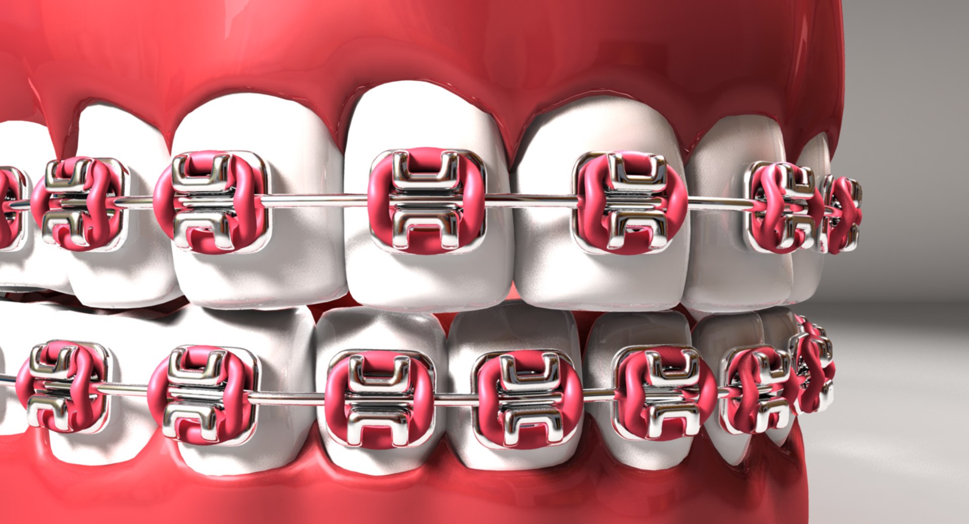 teeth braces 3d model https://p.turbosquid.com/ts-thumb/pS/6oISr2/mZsOCXF2/mouth_07.49/jpg/1541002918/1920x1080/fit_q87/cd50caa7ca121355619d956fd4a8b1d7ee27066b/mouth_07.49.jpg