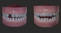 Realistic Children Teeth and Gums