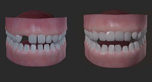 Realistic Children Teeth and Gums