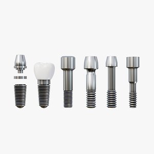3D Dental Implant Pack - 6 in 1 model