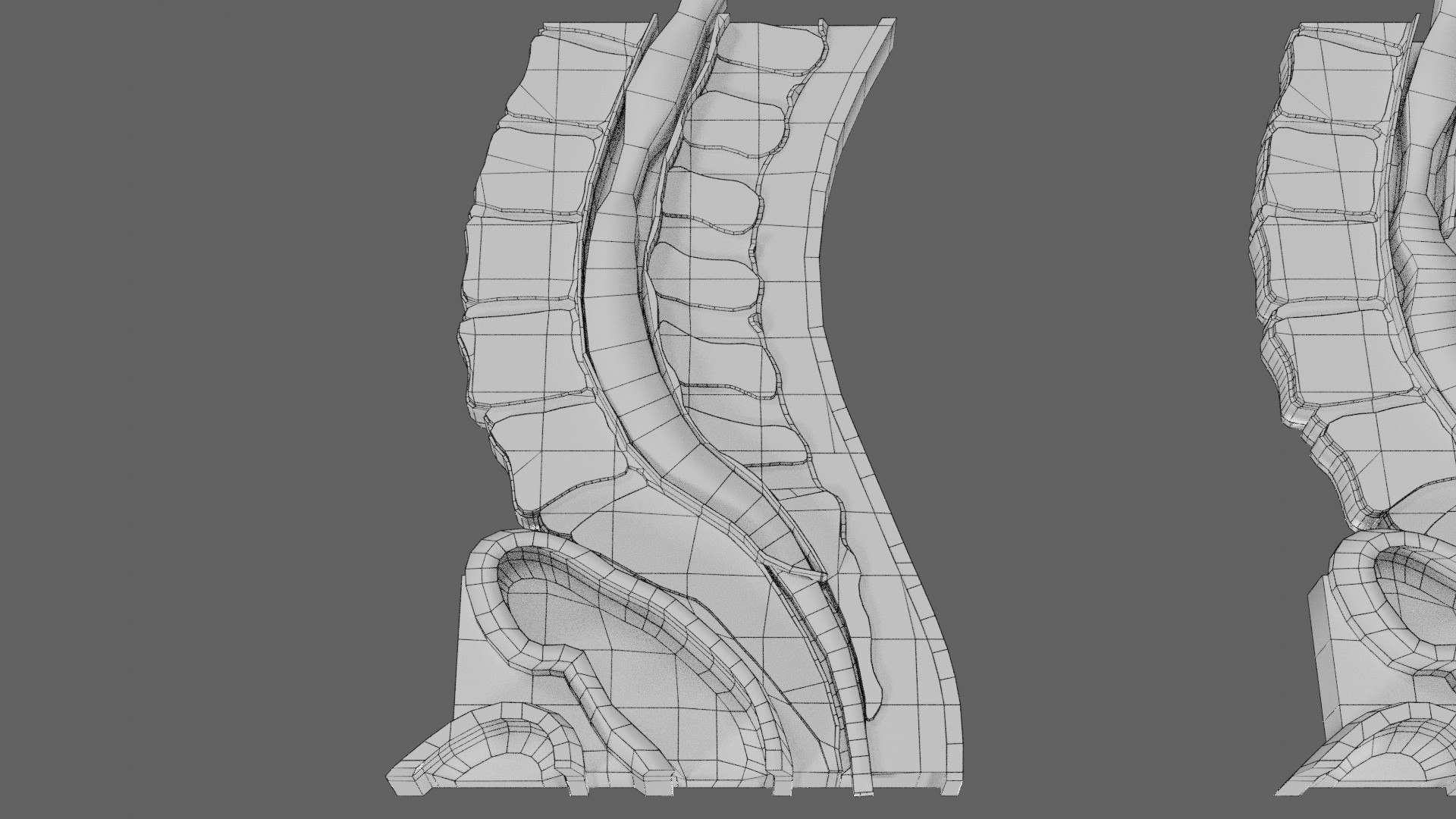 Spina bifida Neural Tube Defect 3D model https://p.turbosquid.com/ts-thumb/pi/sa5DPR/95/wf0015/jpg/1742532001/1920x1080/fit_q87/be04713e8d1badc1072c123a1587815537300eb6/wf0015.jpg