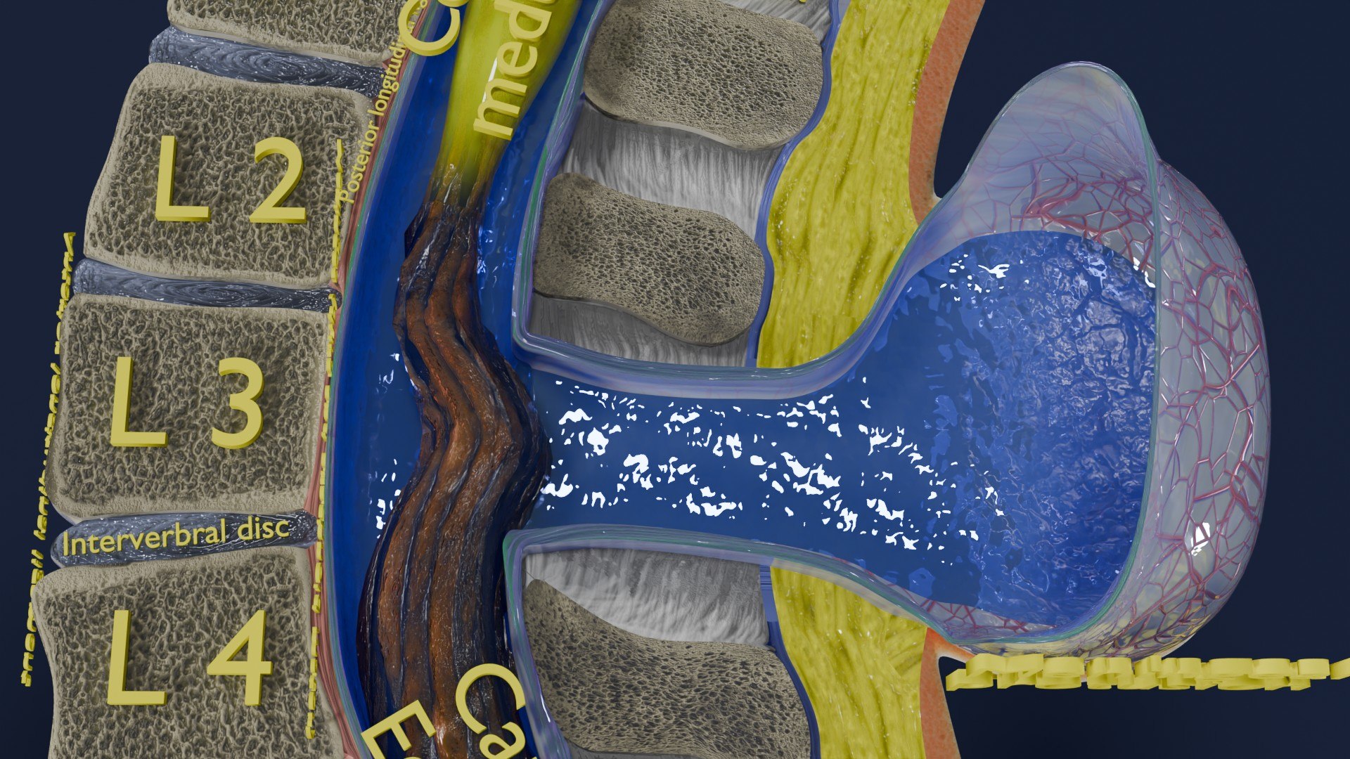 Spina bifida Neural Tube Defect 3D model https://p.turbosquid.com/ts-thumb/pi/sa5DPR/K7/aa0049/jpg/1742531907/1920x1080/fit_q87/a4e4925f0e9b6fd59c881645b0ae08e8bfba6c9d/aa0049.jpg