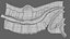 Spina bifida, anomalie du tube neural