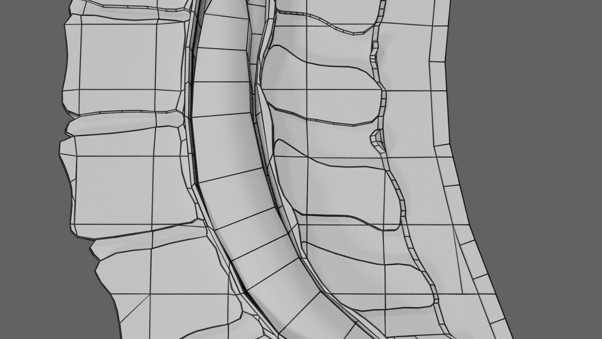 Spina bifida Neural Tube Defect 3D model https://p.turbosquid.com/ts-thumb/pi/sa5DPR/Tr/wf0017/jpg/1742532003/1920x1080/fit_q87/a54443e39b7e4328459b7ac329e07523fa2e838c/wf0017.jpg