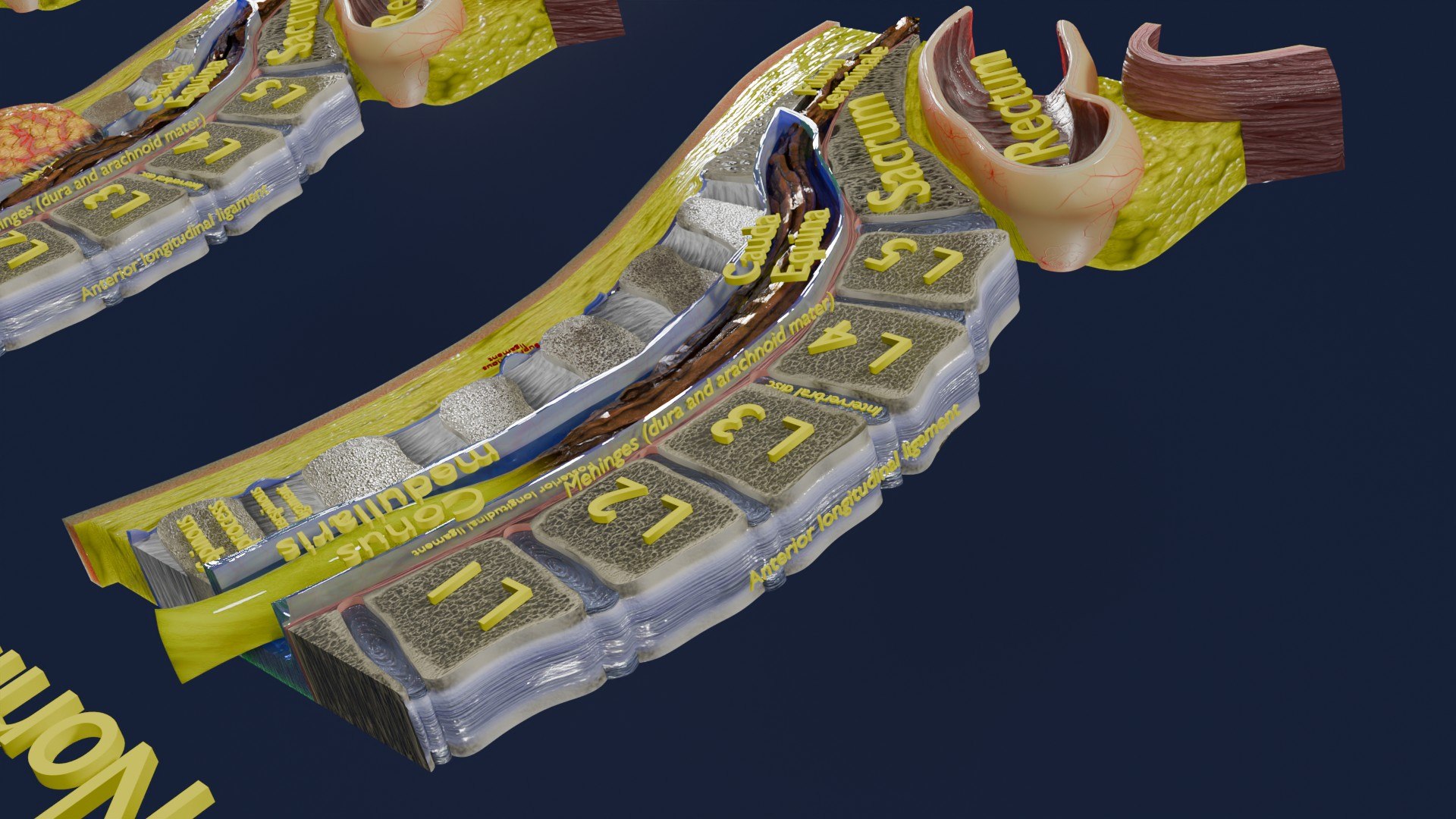 Spina bifida Neural Tube Defect 3D model https://p.turbosquid.com/ts-thumb/pi/sa5DPR/fg/aa0014/jpg/1742531819/1920x1080/fit_q87/0e4a8541be037b2ac699a7cfba743d31ffb285d9/aa0014.jpg