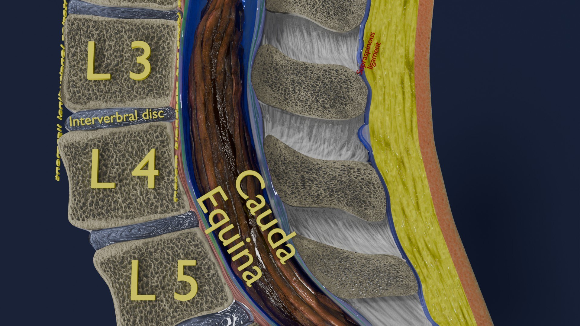 Spina bifida Neural Tube Defect 3D model https://p.turbosquid.com/ts-thumb/pi/sa5DPR/h0/aa0017/jpg/1742531828/1920x1080/fit_q87/ec4f68e0b54da56ab551a24c5a73da201e34ec3d/aa0017.jpg