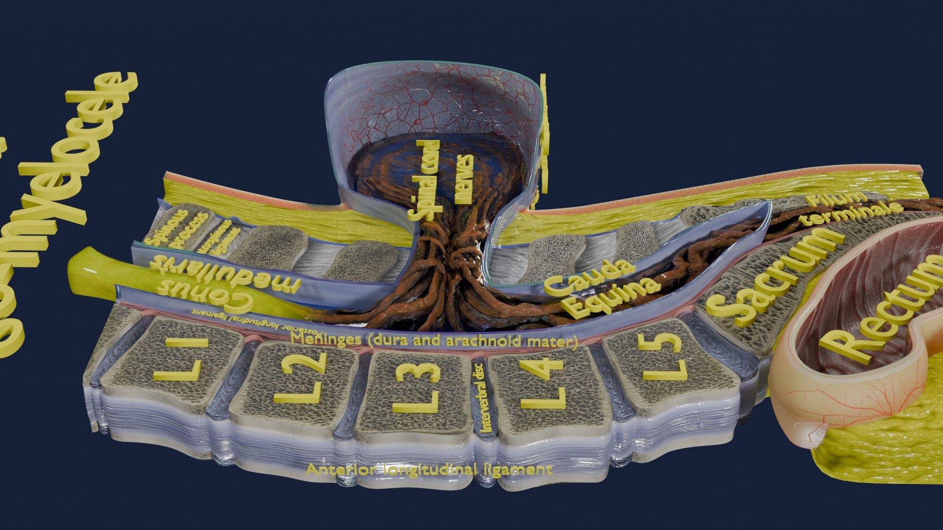 Spina bifida Neural Tube Defect 3D model https://p.turbosquid.com/ts-thumb/pi/sa5DPR/kU/aa0062/jpg/1742531944/1920x1080/fit_q87/ac484eab08abe72522dfde998be947957b2f2faf/aa0062.jpg