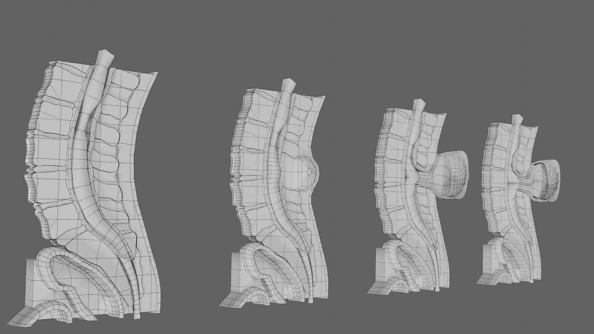 Spina bifida Neural Tube Defect 3D model https://p.turbosquid.com/ts-thumb/pi/sa5DPR/mO/wf0004/jpg/1742531980/1920x1080/fit_q87/364c1c5129636843e7269200f18052d25a7ccbab/wf0004.jpg