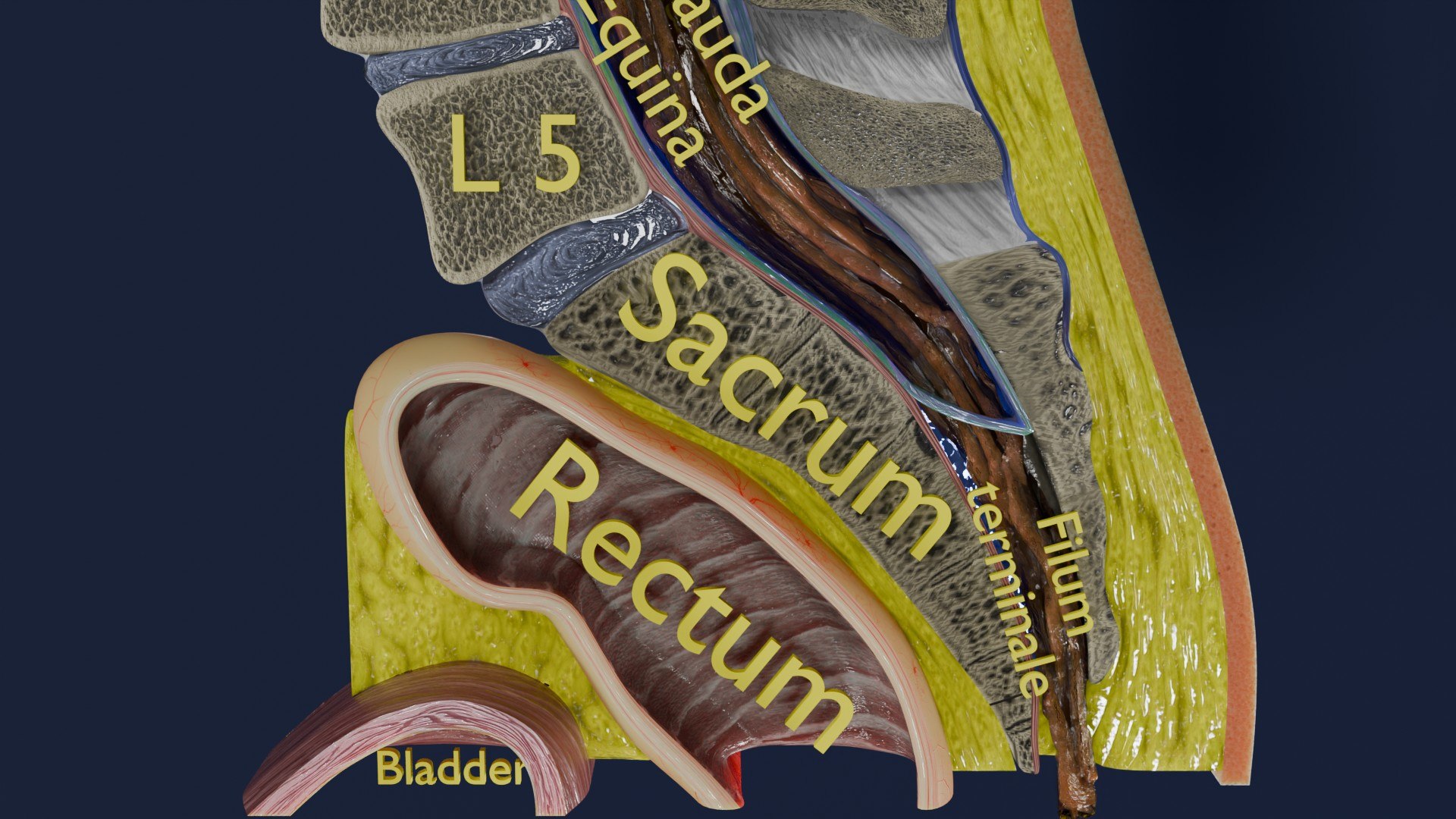 Spina bifida Neural Tube Defect 3D model https://p.turbosquid.com/ts-thumb/pi/sa5DPR/o8/aa0018/jpg/1742531832/1920x1080/fit_q87/40a53cc328b35a2159517f053540c7d6a0067dce/aa0018.jpg