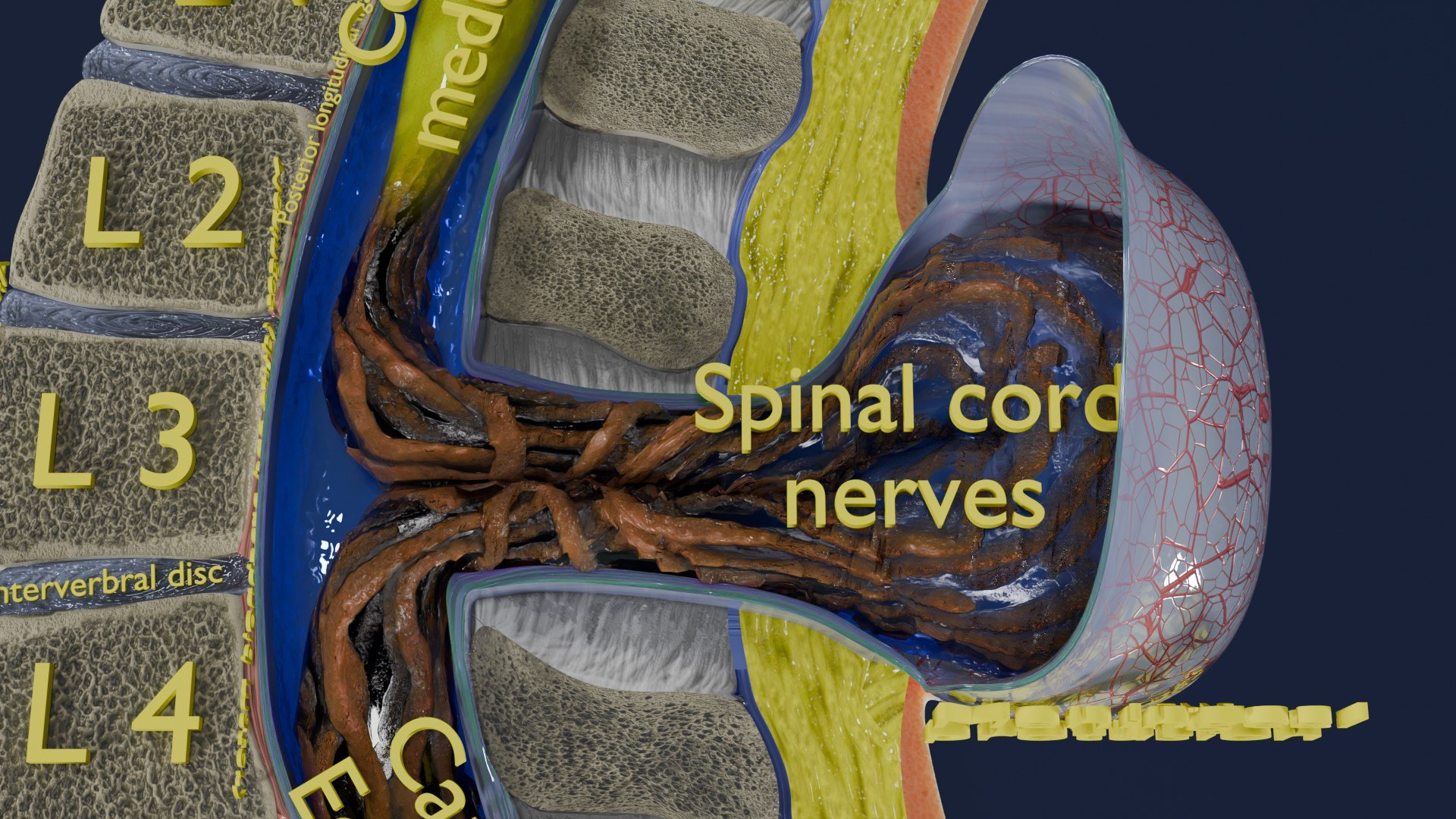 Spina bifida Neural Tube Defect 3D model https://p.turbosquid.com/ts-thumb/pi/sa5DPR/uc/aa0066/jpg/1742531957/1920x1080/fit_q87/f8ad75c99512175d3cdc09416fce2c95f7860e8a/aa0066.jpg