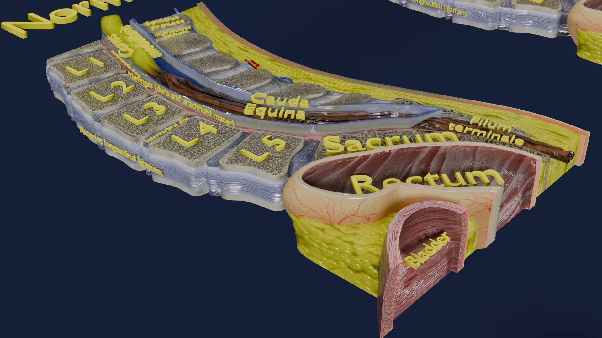 Spina bifida Neural Tube Defect 3D model https://p.turbosquid.com/ts-thumb/pi/sa5DPR/vx/aa0011/jpg/1742531815/1920x1080/fit_q87/5f96f6a6c6d58c063a45e1d07fb325bba51dd6e4/aa0011.jpg