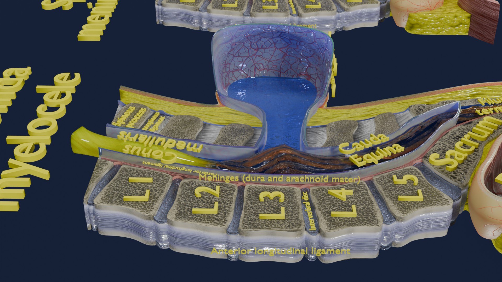 Spina bifida Neural Tube Defect 3D model https://p.turbosquid.com/ts-thumb/pi/sa5DPR/wC/aa0045/jpg/1742532000/1920x1080/fit_q87/5bfd1eaa8b5de83f4276e502e3d272ff1d668aa9/aa0045.jpg