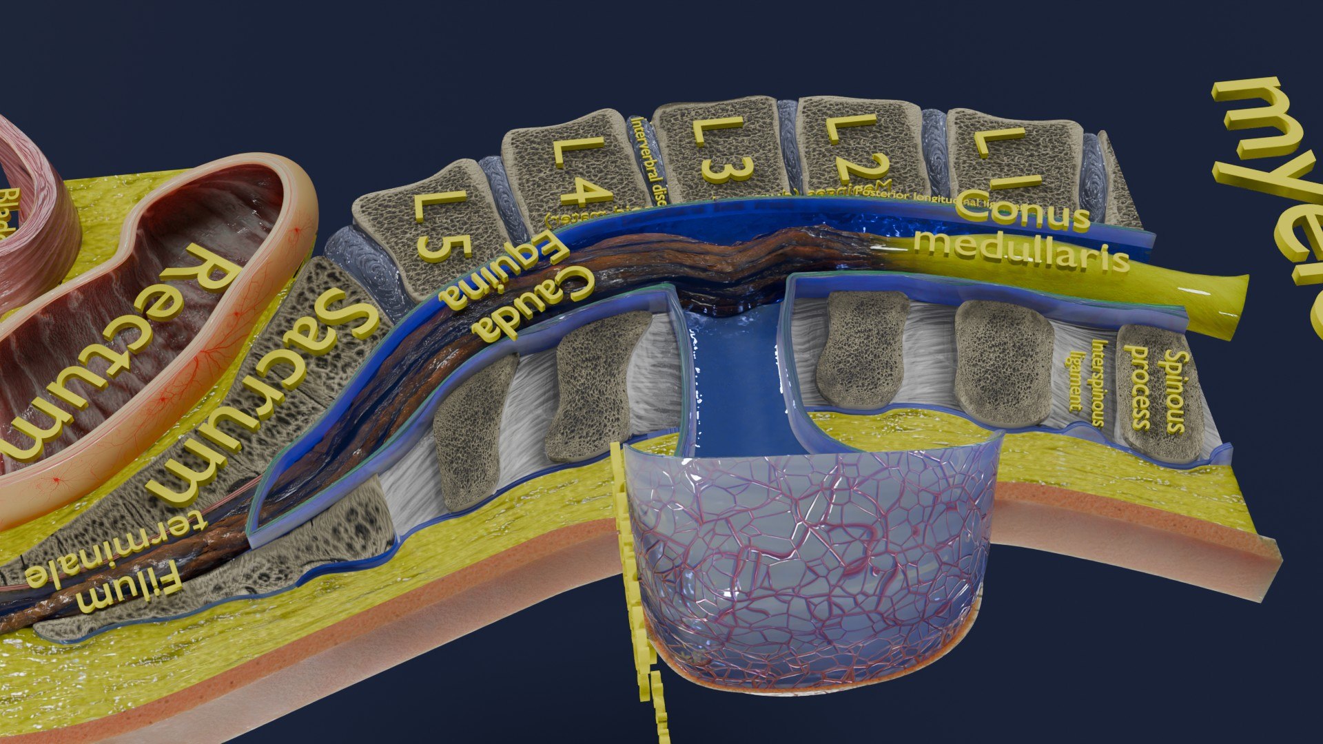 Spina bifida Neural Tube Defect 3D model https://p.turbosquid.com/ts-thumb/pi/sa5DPR/wY/aa0050/jpg/1742531910/1920x1080/fit_q87/891f5fa3664c684ba341dfa2e7fcebef1198edf2/aa0050.jpg