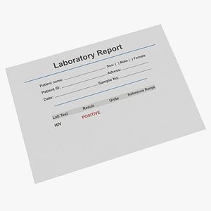 Laboratory HIV Report Form Negative