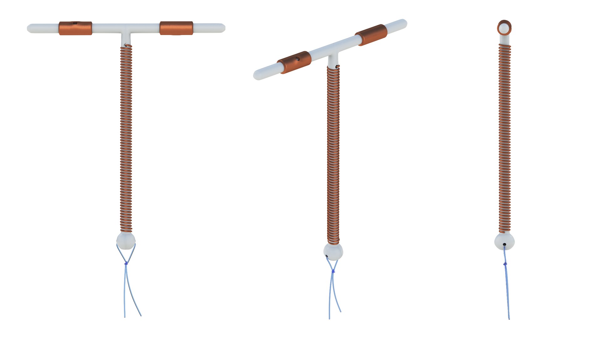 3D Copper Intrauterine Device TIUD Model TurboSquid 1926857