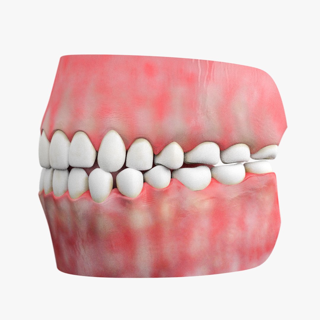 3d Model Teeth Gum