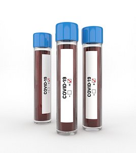 Coronavirus blood sample