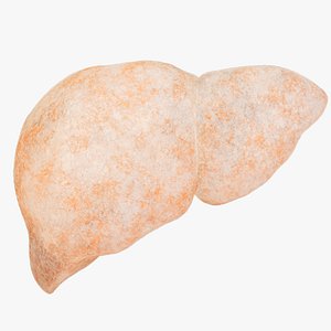 3D Liver fibrosis digestive system organs model