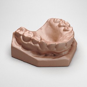 Dental Cast
