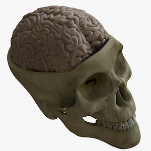 Human Skull with Brain