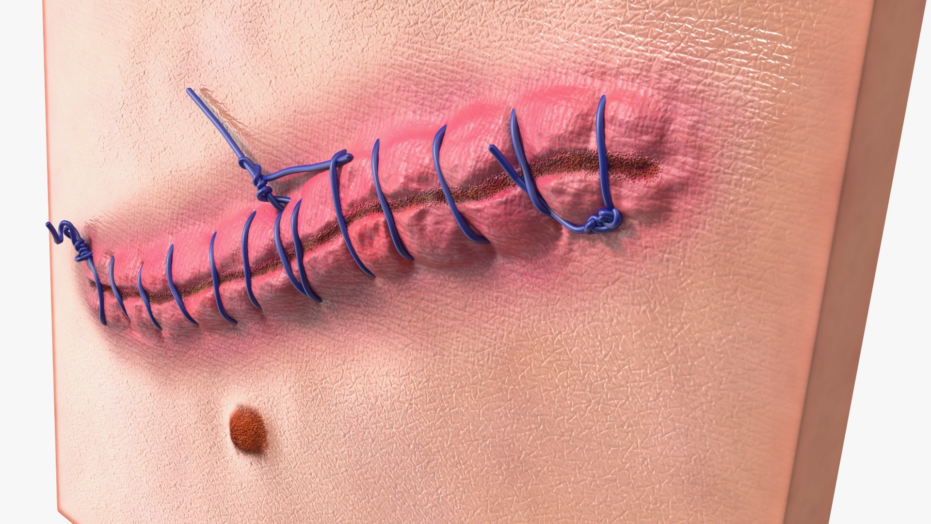 3D model Skin with Medical Seam Open https://p.turbosquid.com/ts-thumb/qO/oGJih3/MR/skinwithmedicalseamopenmb3dmodel014/jpg/1701843303/1920x1080/fit_q87/97ad52e1f2aa2aed39a1a30f5efb10b09745e478/skinwithmedicalseamopenmb3dmodel014.jpg