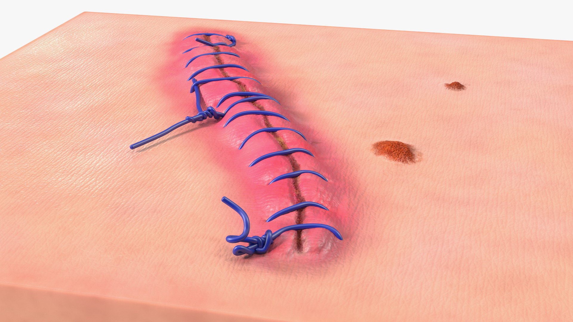 3D model Skin with Medical Seam Open https://p.turbosquid.com/ts-thumb/qO/oGJih3/Qo/skinwithmedicalseamopenmb3dmodel013/jpg/1701843298/1920x1080/fit_q87/6663450cc215f9e49e617b7796c18ea3cbb1db8a/skinwithmedicalseamopenmb3dmodel013.jpg