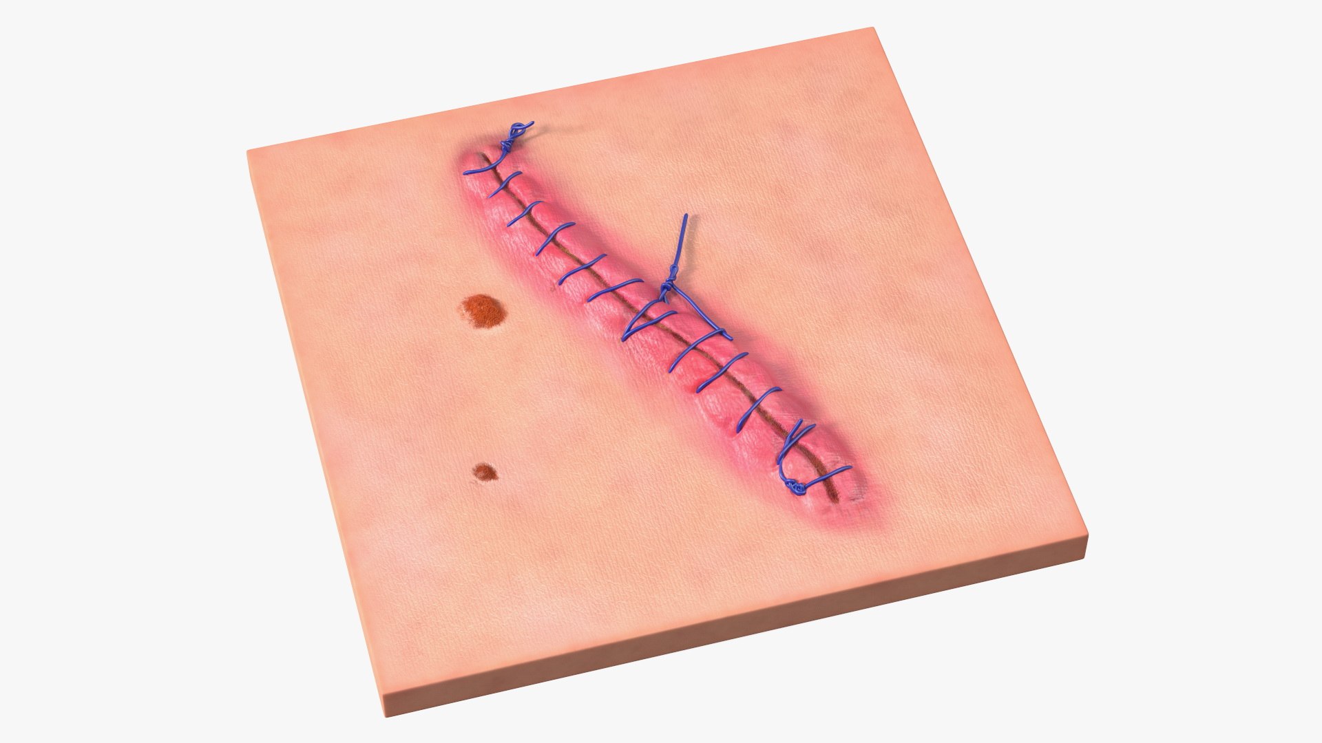 3D model Skin with Medical Seam Open https://p.turbosquid.com/ts-thumb/qO/oGJih3/TR/skinwithmedicalseamopenmb3dmodel008/jpg/1701843281/1920x1080/fit_q87/09e3870b4d51670ca8704024b08ffb05dde0c541/skinwithmedicalseamopenmb3dmodel008.jpg