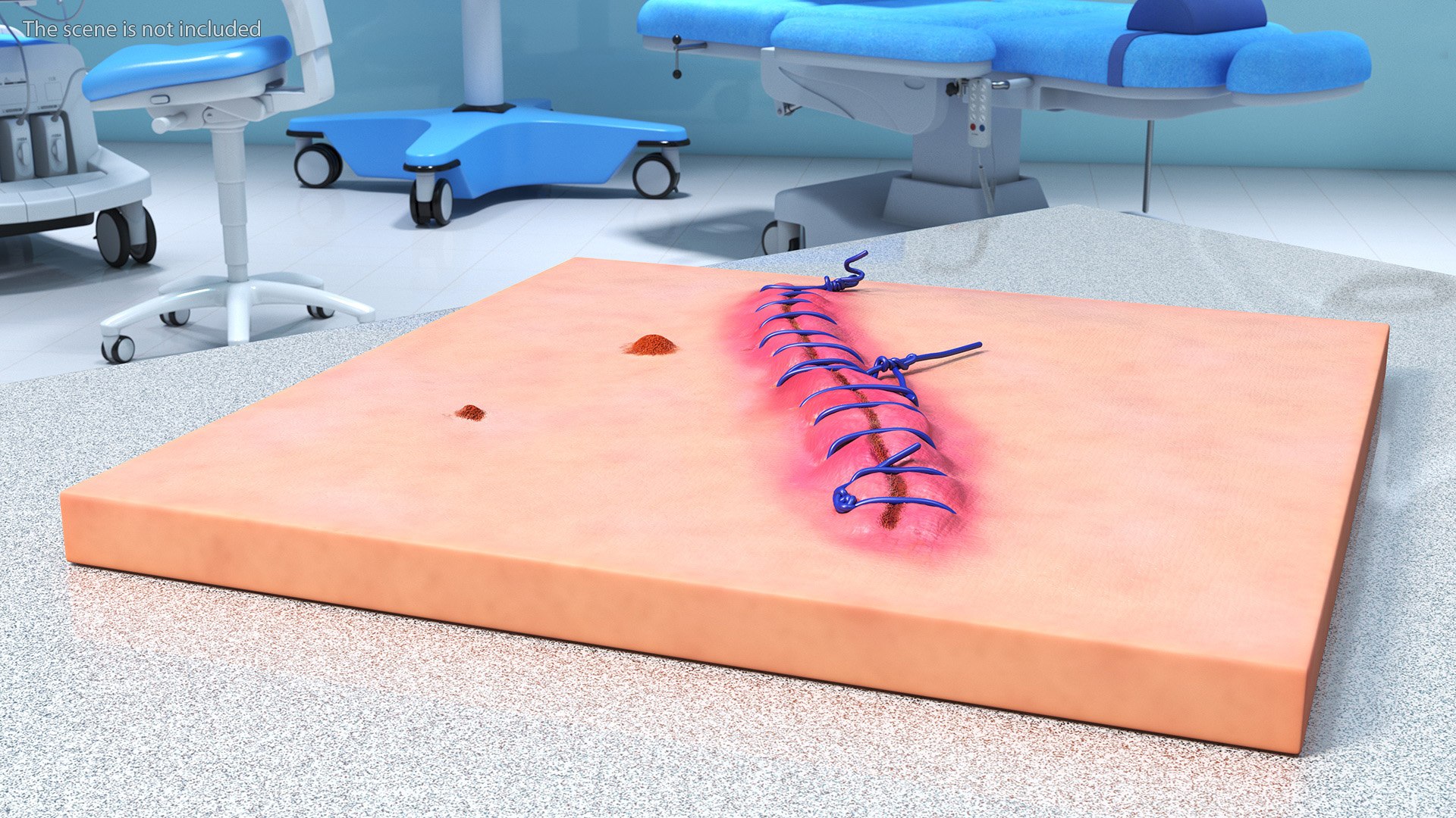 3D model Skin with Medical Seam Open https://p.turbosquid.com/ts-thumb/qO/oGJih3/bA/skinwithmedicalseamopenmb3dmodel002/jpg/1701843259/1920x1080/fit_q87/f48f10f3a9a18e1264387995018cd12935c28e36/skinwithmedicalseamopenmb3dmodel002.jpg