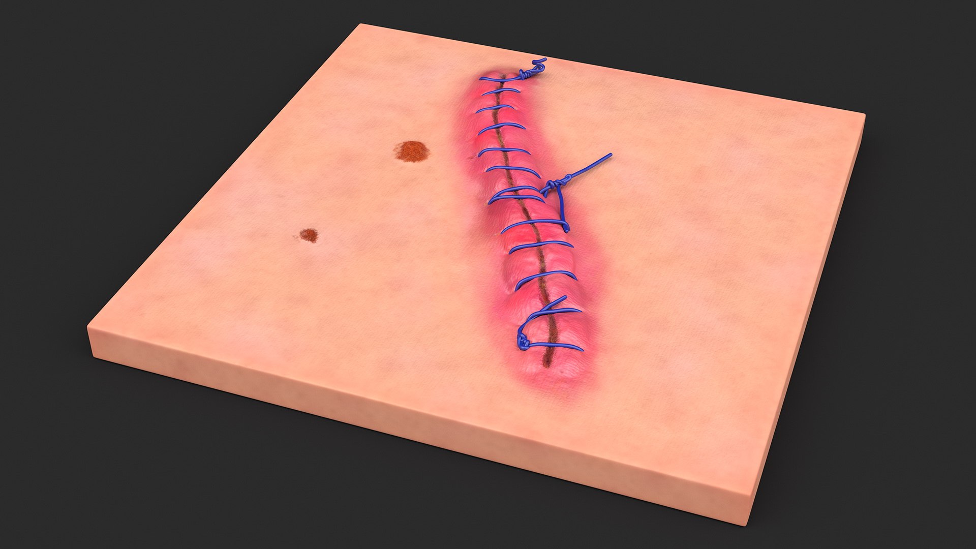 3D model Skin with Medical Seam Open https://p.turbosquid.com/ts-thumb/qO/oGJih3/ca/skinwithmedicalseamopenmb3dmodel006/jpg/1701843273/1920x1080/fit_q87/35194fff0baae83f2ddba4fba91d90f6e5aef38b/skinwithmedicalseamopenmb3dmodel006.jpg