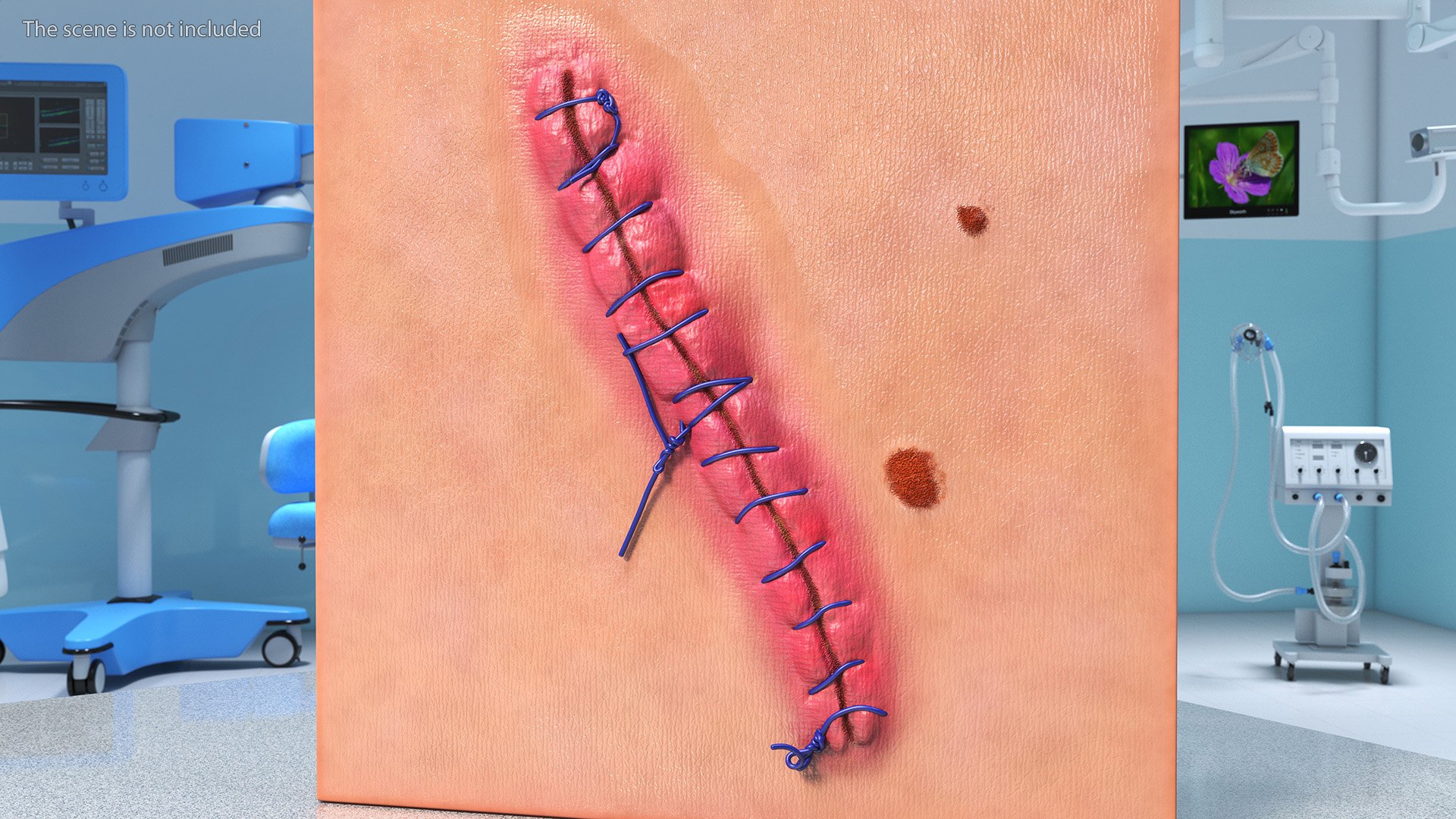 3D model Skin with Medical Seam Open https://p.turbosquid.com/ts-thumb/qO/oGJih3/dn/skinwithmedicalseamopenmb3dmodel004/jpg/1701843266/1920x1080/fit_q87/94ddda8e97f9d63417c491df0d0c9dc9b51623f8/skinwithmedicalseamopenmb3dmodel004.jpg