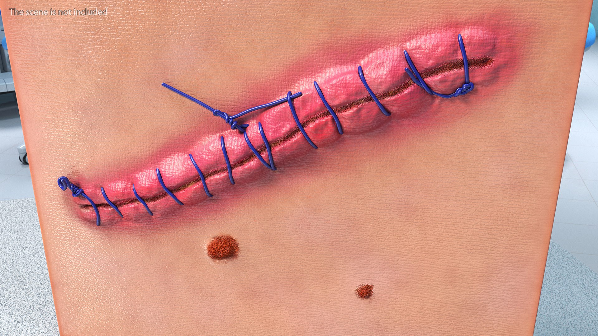 3D model Skin with Medical Seam Open https://p.turbosquid.com/ts-thumb/qO/oGJih3/ed/skinwithmedicalseamopenmb3dmodel005/jpg/1701843270/1920x1080/fit_q87/76238e67ff0f5a32cf389302561b0378a28ce9fd/skinwithmedicalseamopenmb3dmodel005.jpg