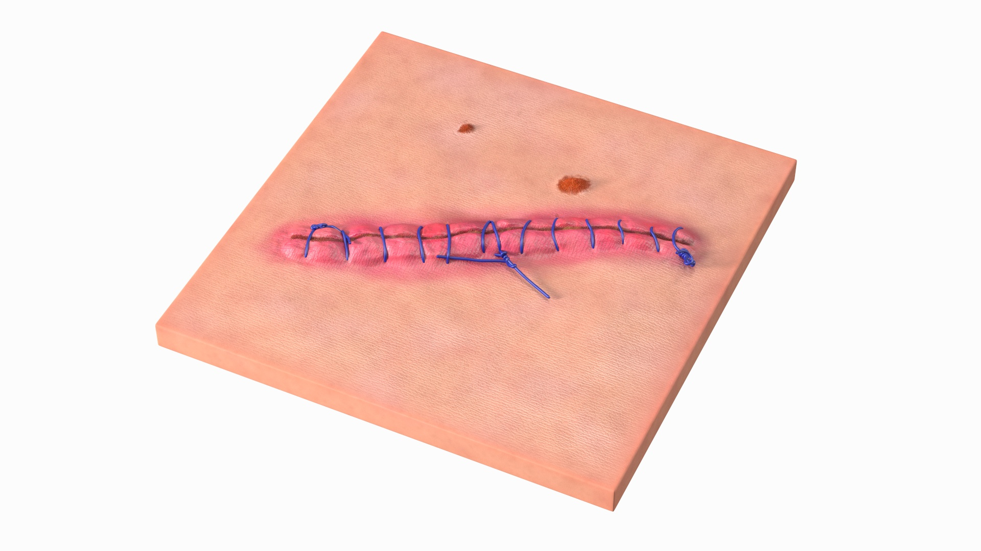 3D model Skin with Medical Seam Open https://p.turbosquid.com/ts-thumb/qO/oGJih3/kj/skin_with_medical_seam_open_360/jpg/1701842804/1920x1080/turn_fit_q99/ad0e95468302d6479f255760eb7aeb9b8b890b09/skin_with_medical_seam_open_360-1.jpg