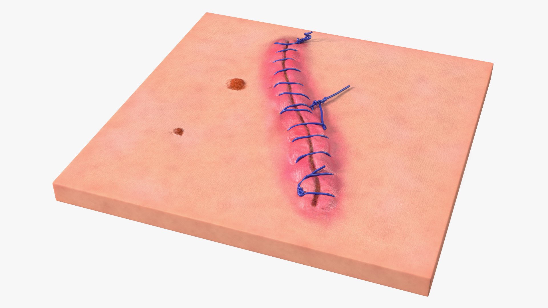 3D model Skin with Medical Seam Open https://p.turbosquid.com/ts-thumb/qO/oGJih3/ko/skinwithmedicalseamopenmb3dmodel009/jpg/1701843284/1920x1080/fit_q87/383a89b3b436c83251f8a48bcbb6f6b367ef16f6/skinwithmedicalseamopenmb3dmodel009.jpg