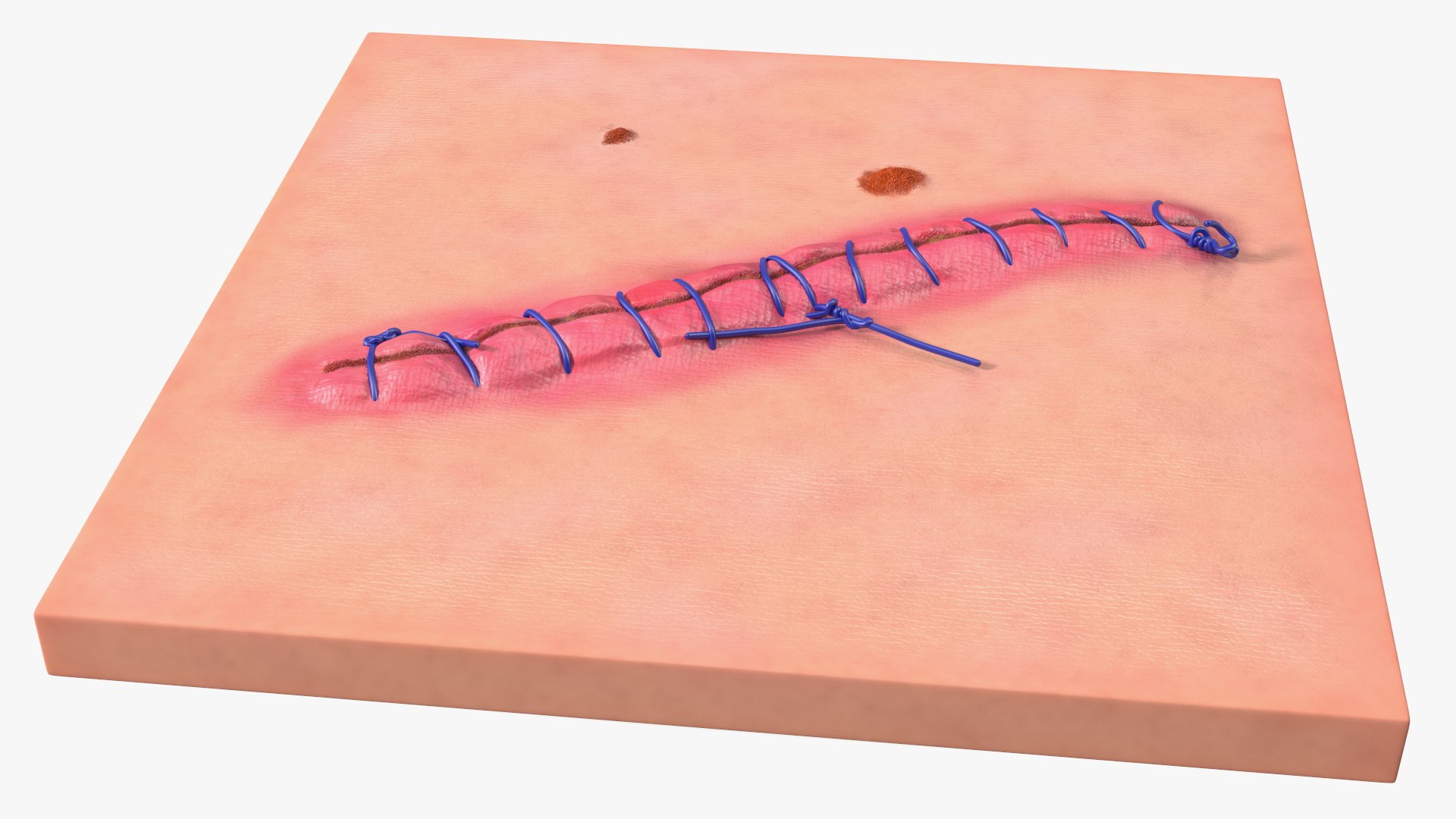3D model Skin with Medical Seam Open https://p.turbosquid.com/ts-thumb/qO/oGJih3/oB/skinwithmedicalseamopenmb3dmodel010/jpg/1701843288/1920x1080/fit_q87/da2f6ff994ede87c0665869e99712821c01b8e70/skinwithmedicalseamopenmb3dmodel010.jpg