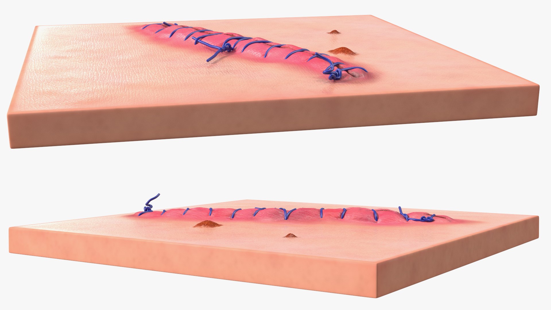 3D model Skin with Medical Seam Open https://p.turbosquid.com/ts-thumb/qO/oGJih3/xO/skinwithmedicalseamopenmb3dmodel011/jpg/1701843292/1920x1080/fit_q87/ecb951d95c02babea20cc106d03248f2fb6126a4/skinwithmedicalseamopenmb3dmodel011.jpg