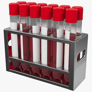 Stainless Steel Test Tube Rack with Blood Samples
