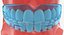 typodont transparent removable retainer 3D