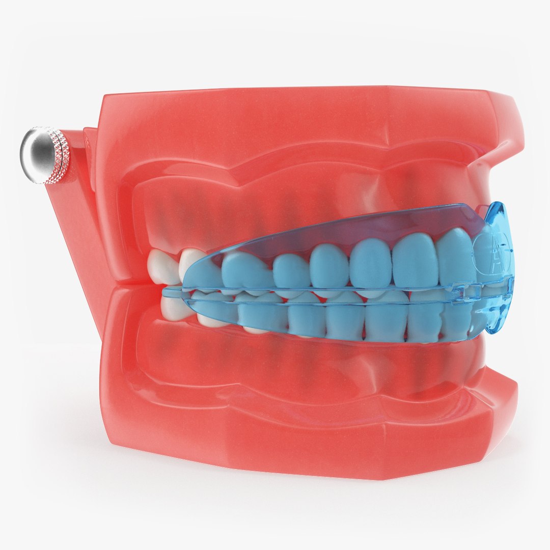 typodont transparent removable retainer 3D https://p.turbosquid.com/ts-thumb/qa/lmbYwz/ciN3wfFP/typodontwithtransparentremovableretainermb3dmodel000/jpg/1534337649/1920x1080/fit_q87/33c86574a0a9b28a1dc9b466918a16eb312786f9/typodontwithtransparentremovableretainermb3dmodel000.jpg