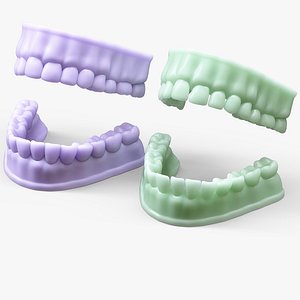 Dentures Mold model