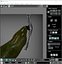 3D Gallbladder model