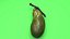 3D Gallbladder model