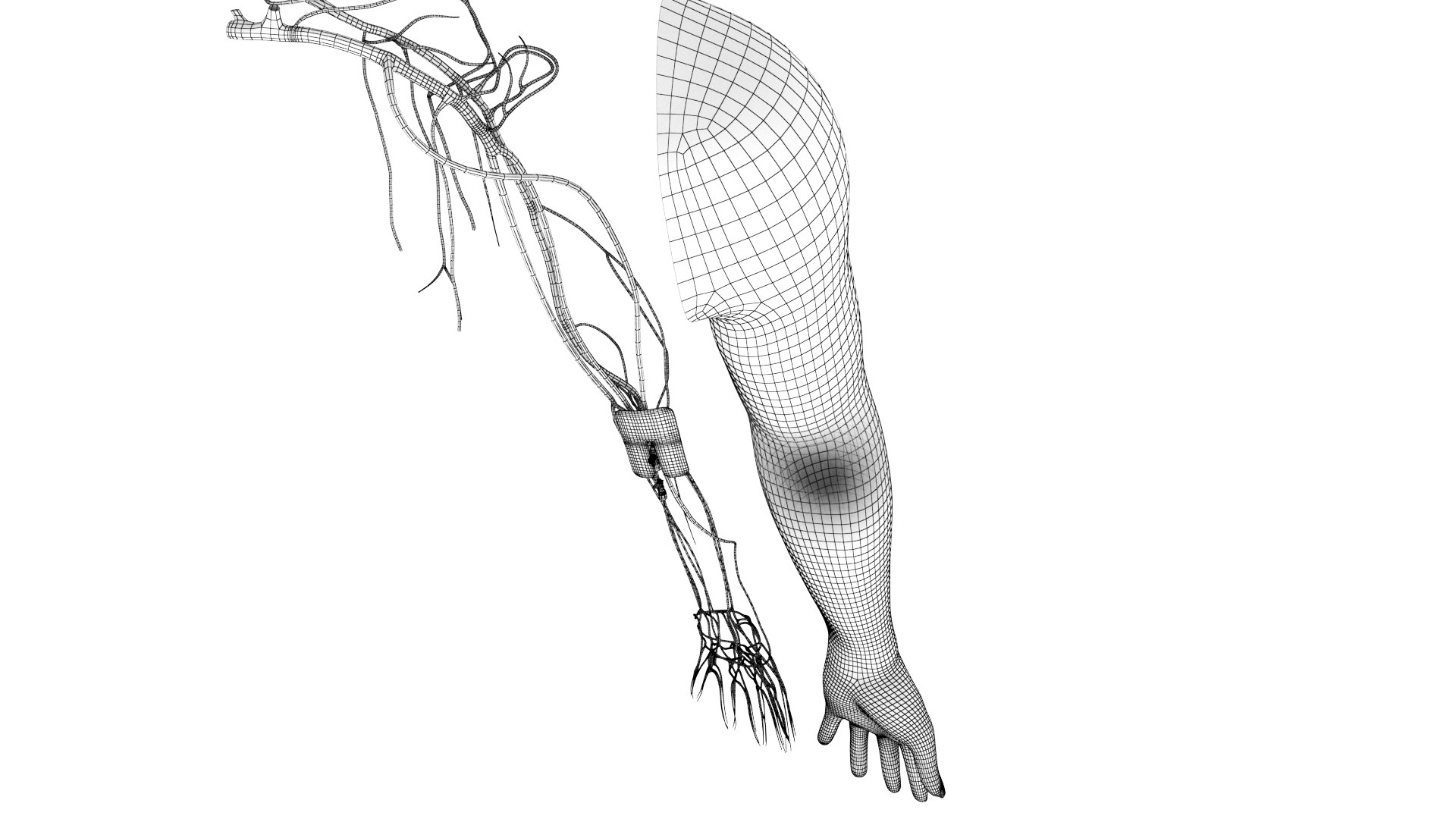 Upper limb Injected Cannula with sticky plaster 3D https://p.turbosquid.com/ts-thumb/qc/nWU4KQ/HZ/b.rgb_color.0007/png/1674209951/1920x1080/fit_q87/fe3b9c404479bba53fde61390640d3ed46b31a73/b.rgb_color.0007.jpg